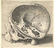 Sectioned skull in profile to left with the left side of the cranium removed